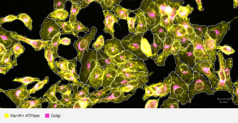 ATP1A1-target-golgi-hela