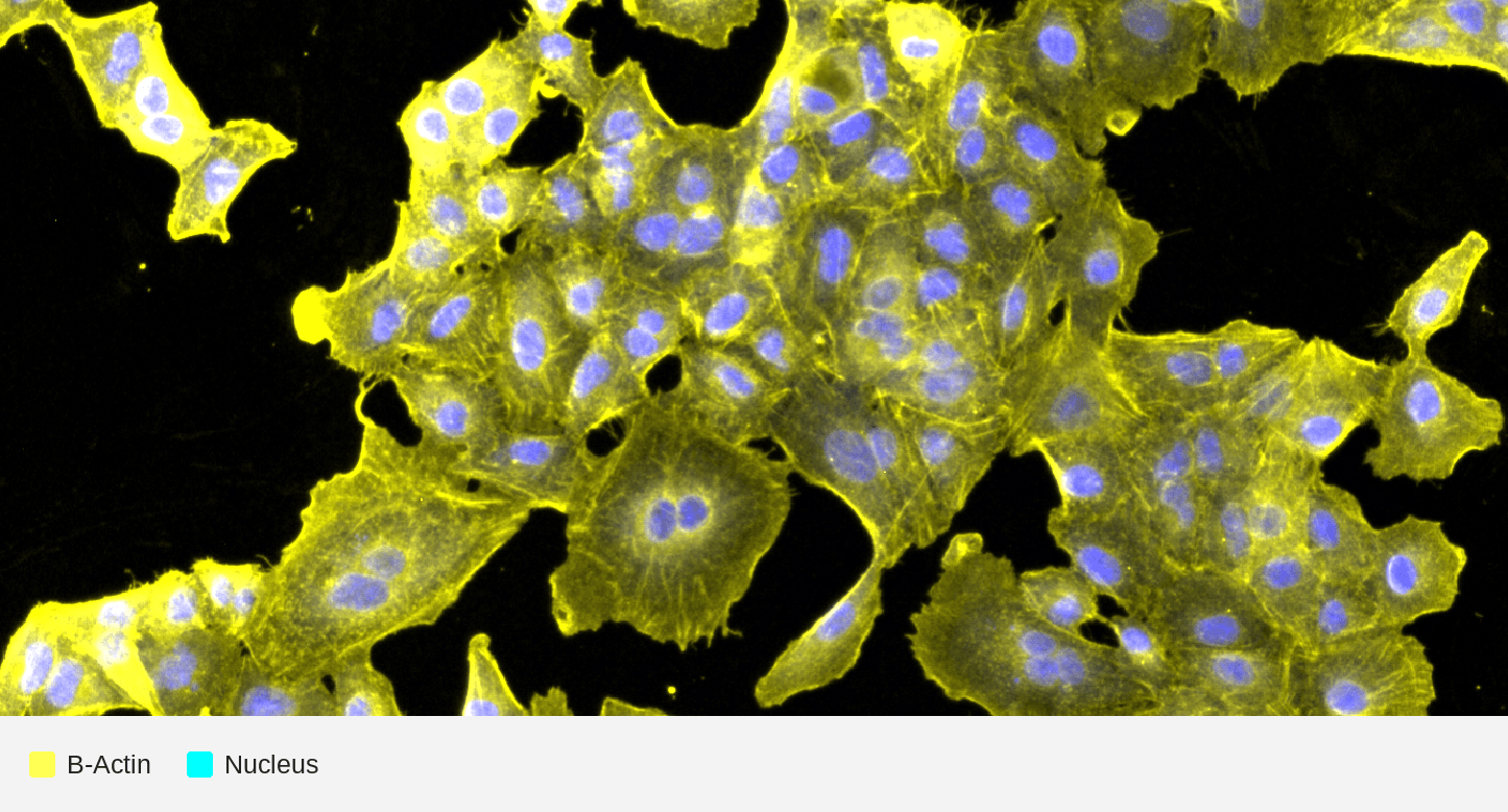 B-actin_nucleus