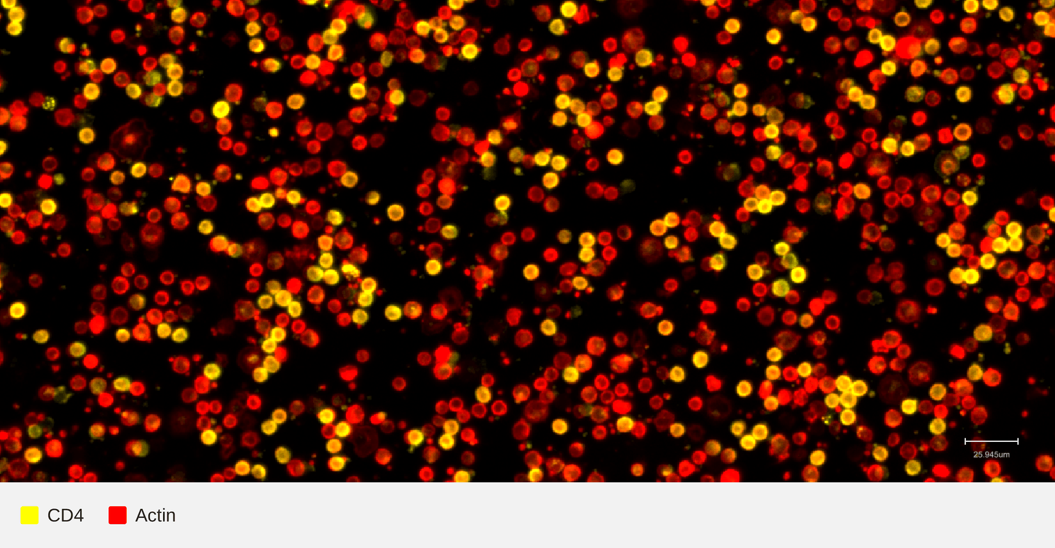 CD4-target-actin-pbmc