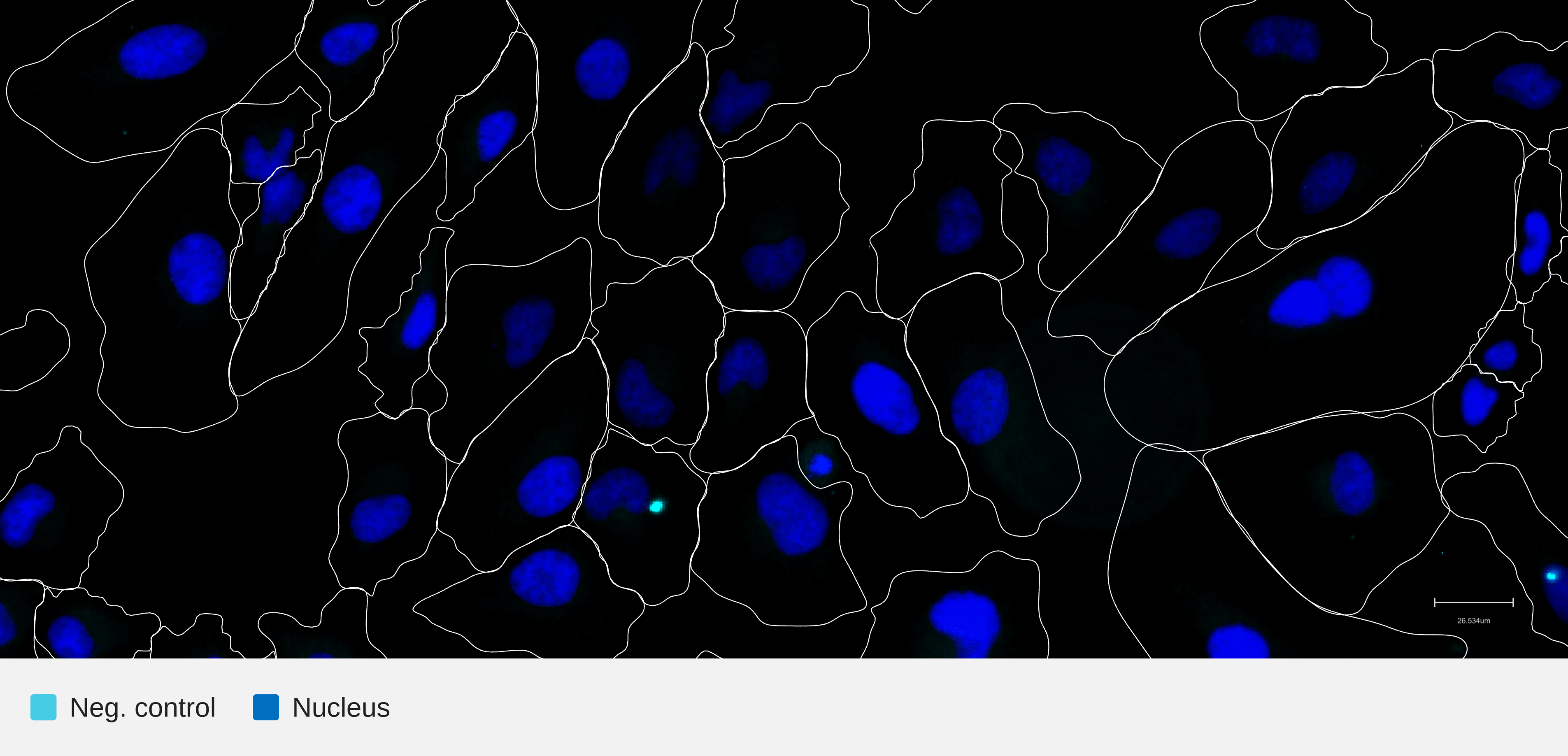 ERK-negctrl-nucleus-hela-wt