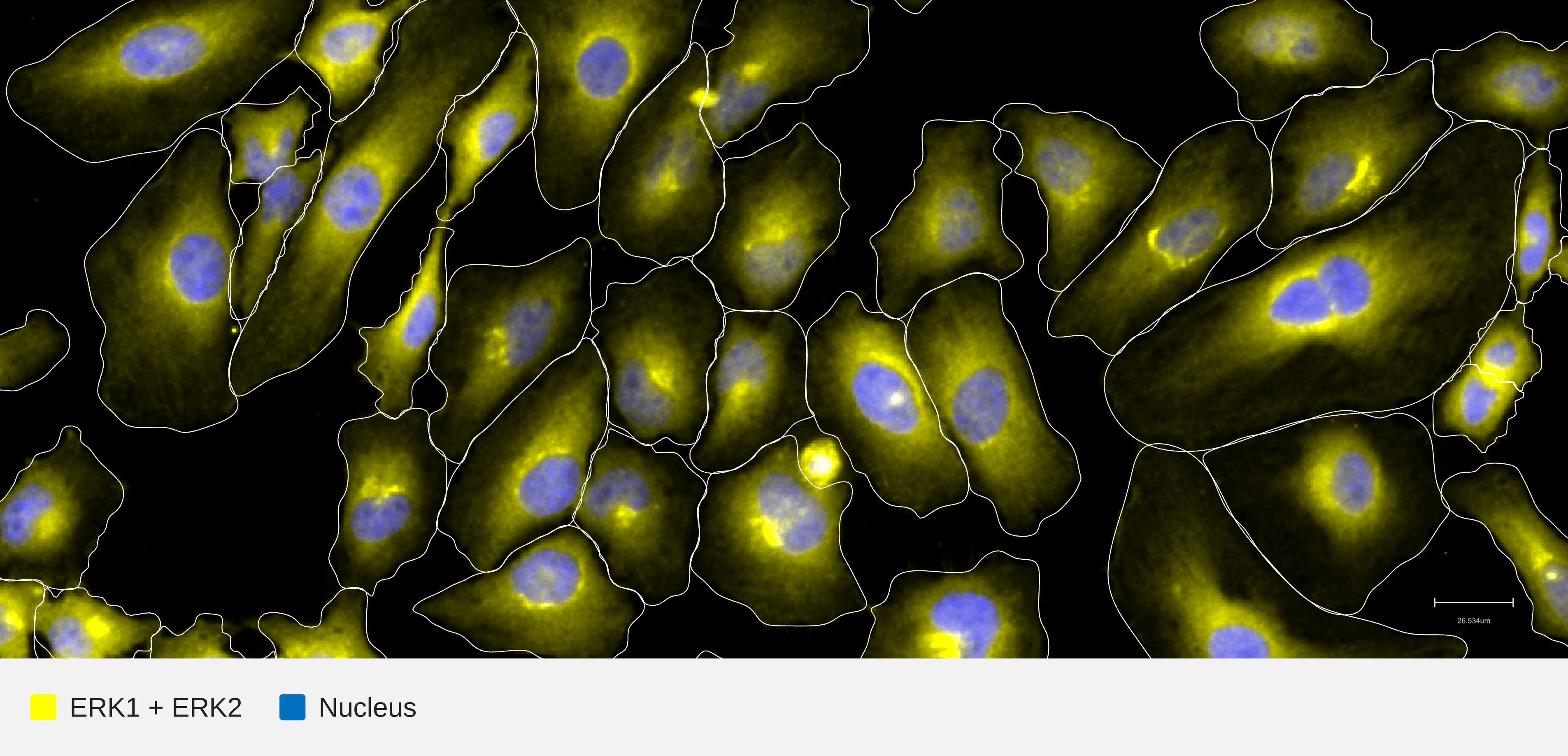 ERK-target-nucleus-hela-wt