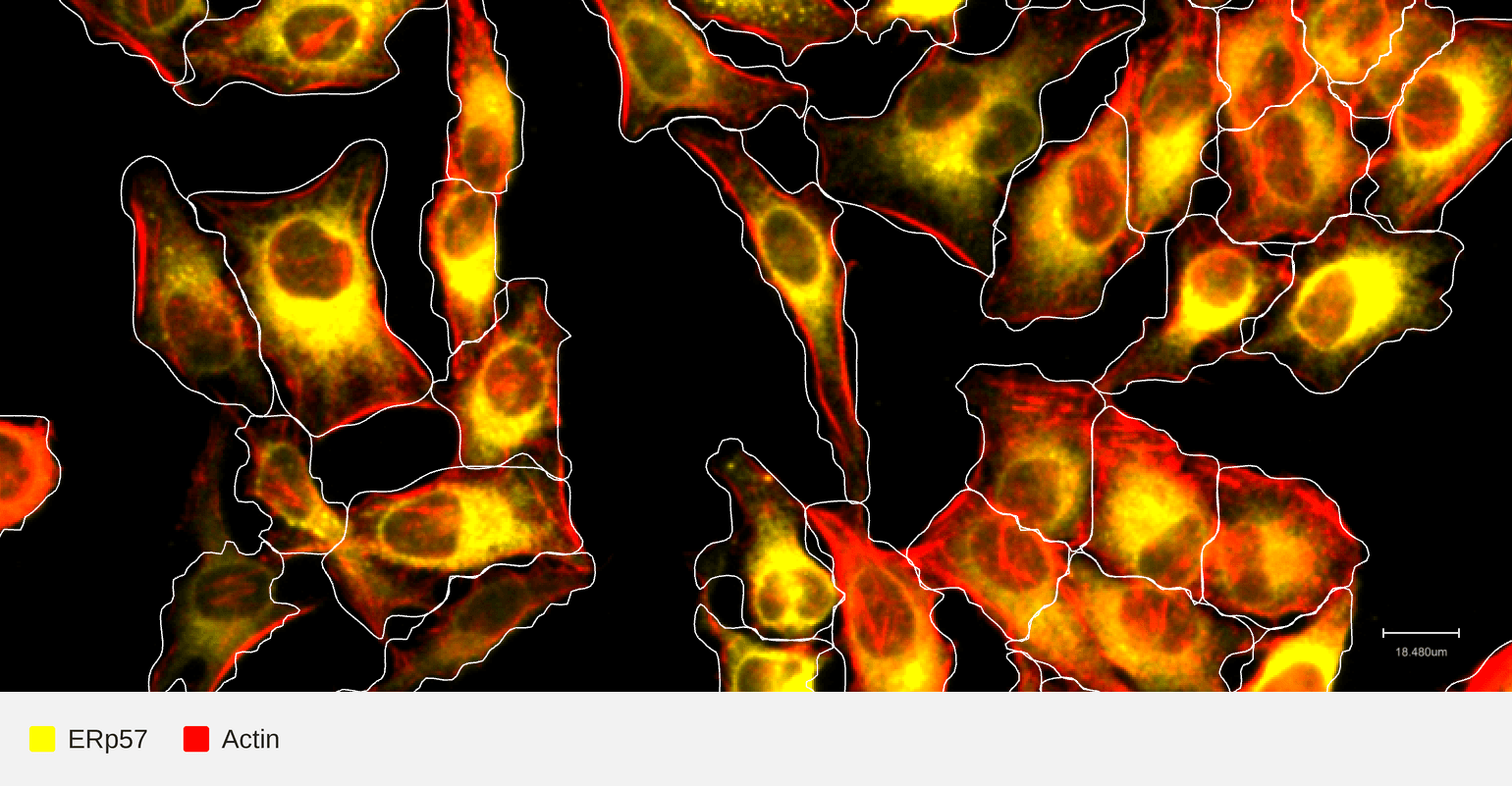 ERp57-target-actin-hela