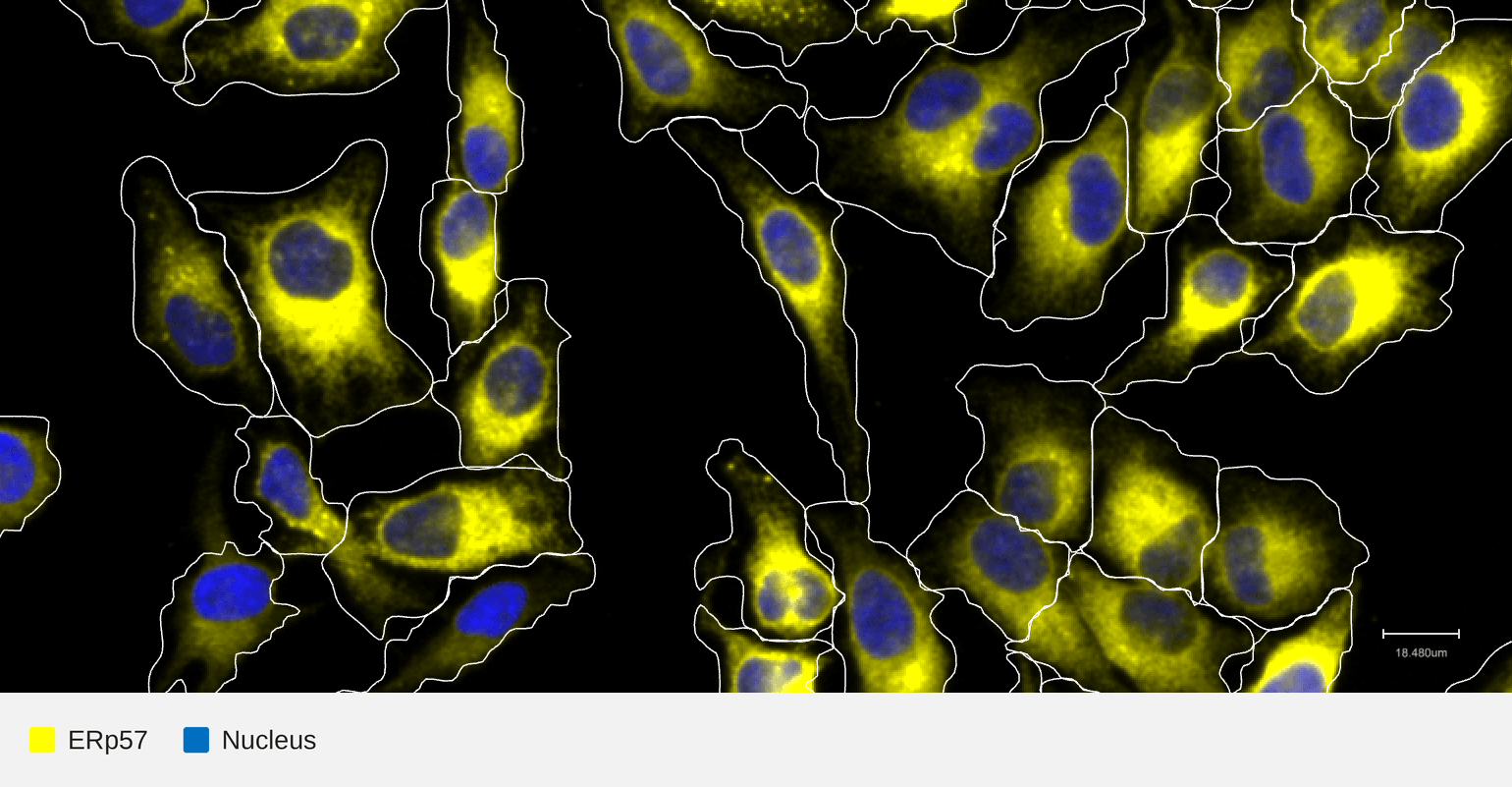 ERp57-target-nucleus-hela