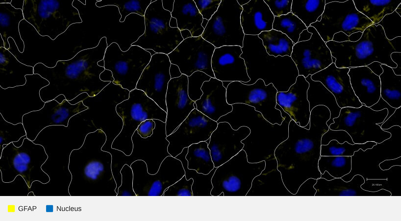 GFAP-target-nucleus-hmc3