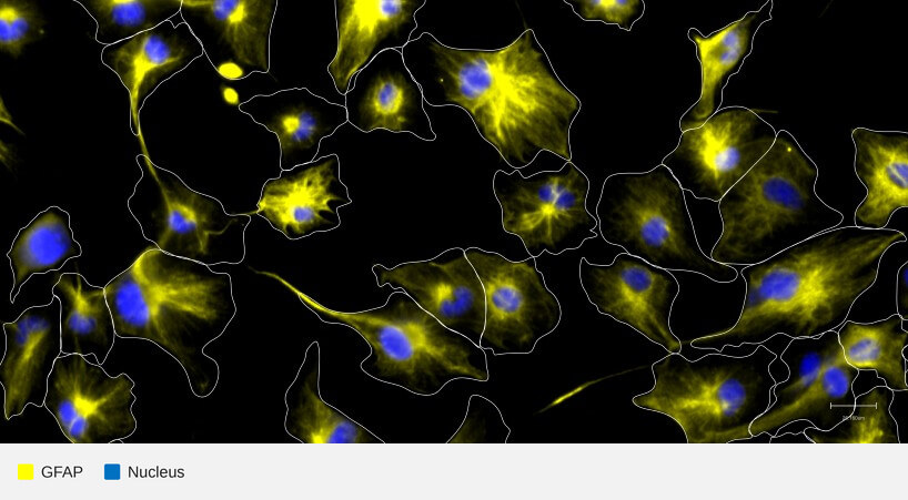 GFAP-target-nucleus-u251