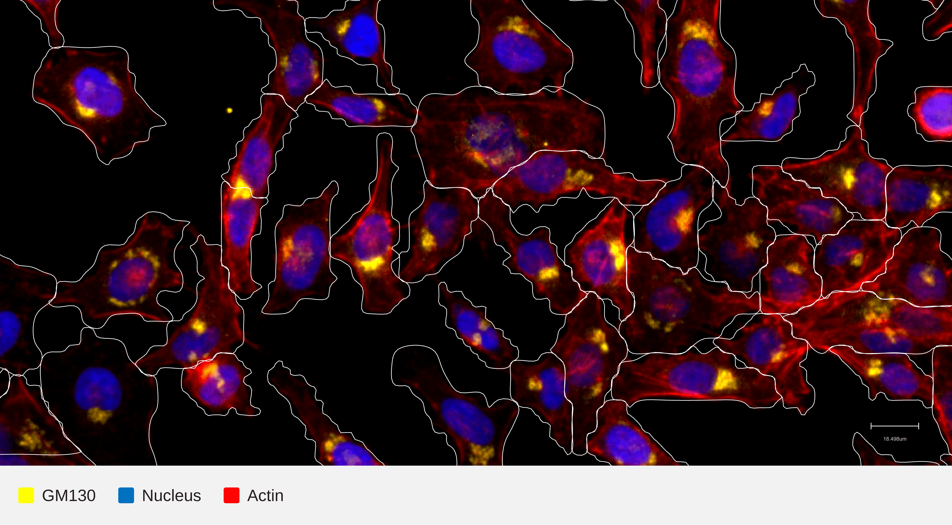 GM130-target-nucleus-actin-hela