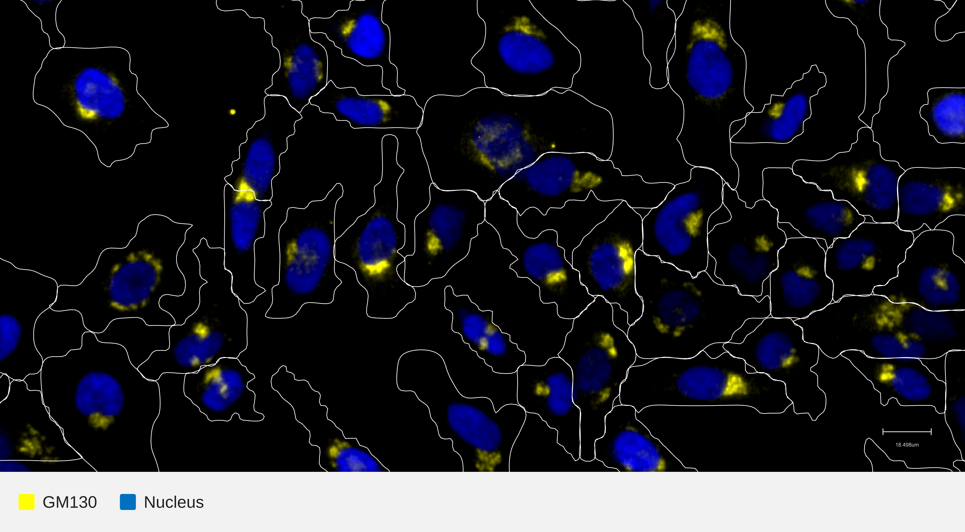 GM130-target-nucleus-hela