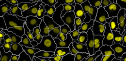 Histone target only