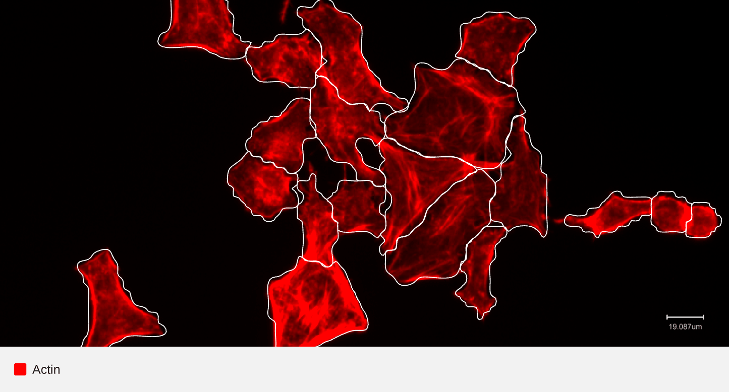 LAMP2-actin