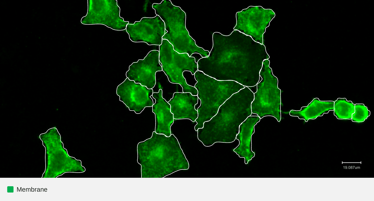 LAMP2-membrane 