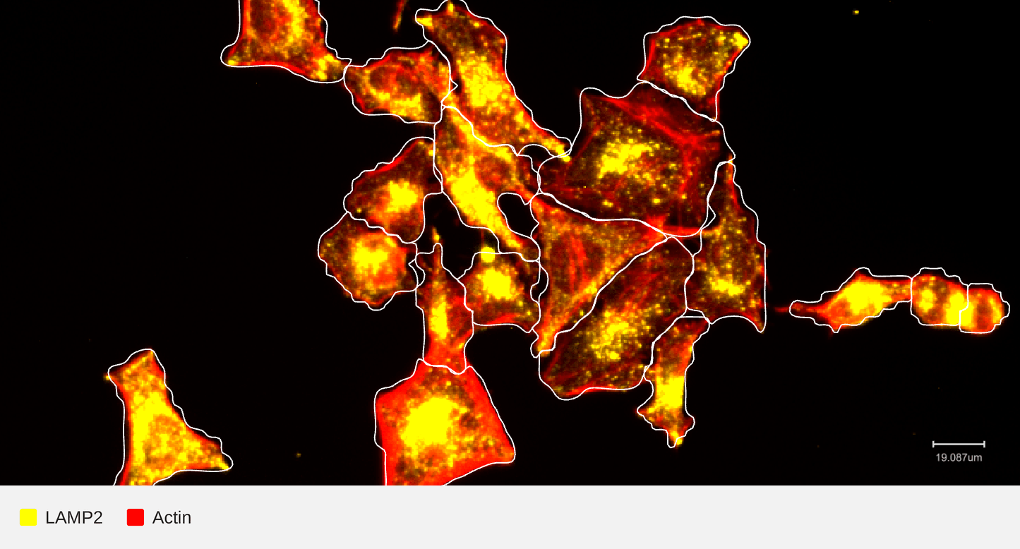 LAMP2-target-actin