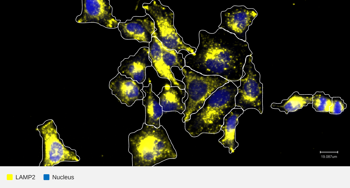 LAMP2-target-nucleus