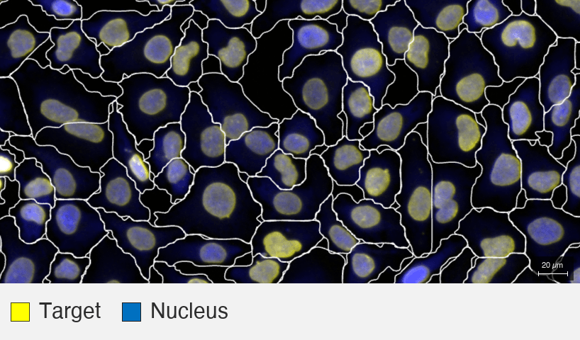 Lamin-AC_MBA-0804_HeLa-F1_2_target+nucleus (2) (1)
