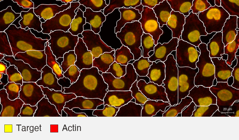 Lamin-AC_MBA-0804_HeLa-F1_4_target+actin (2) (1)