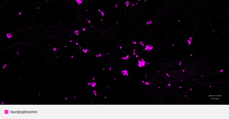 MAP2-npm1-ipsc-neurons (1)