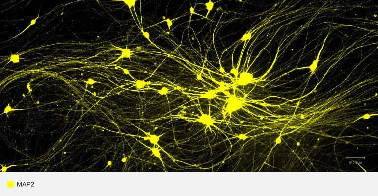 MAP2-target-ipsc-neurons (1)