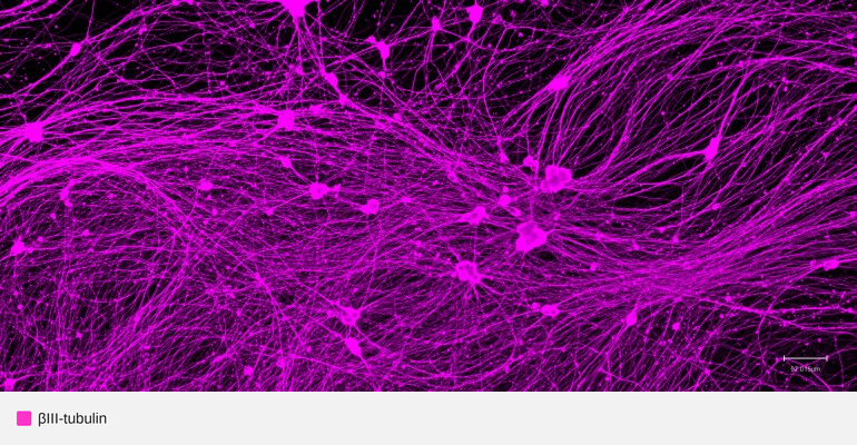 MAP2-tubb3-ipsc-neurons (1)