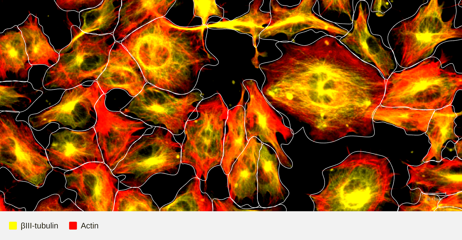 TUBB3-target-actin (1)