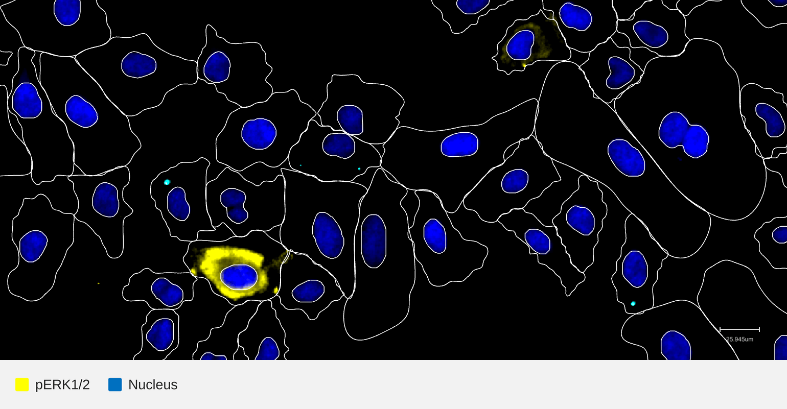 pERK-target-nucleus-hela-lpp (1)