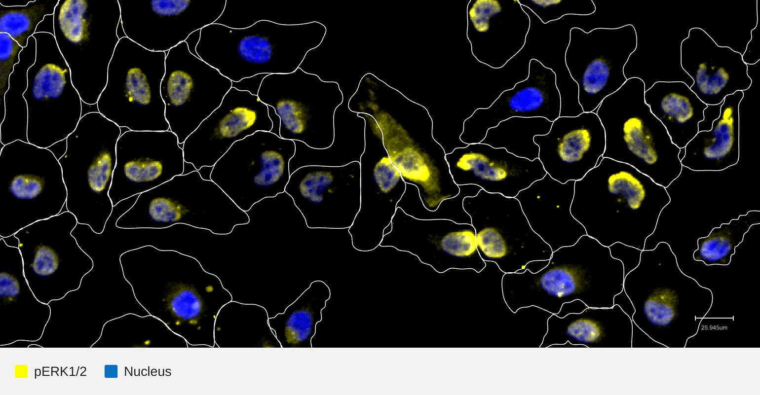 pERK-target-nucleus-hela-wt (1)