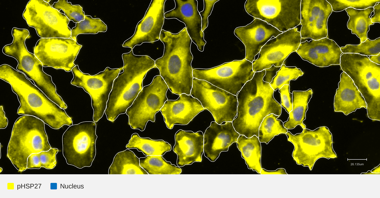 pHSP27-target-nucleus-hela-tnfa30min (1)