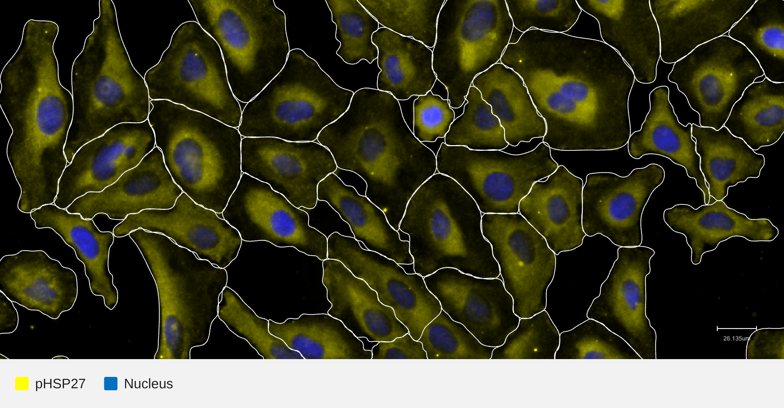 pHSP27-target-nucleus-hela-tnfa30min-lpp (1)