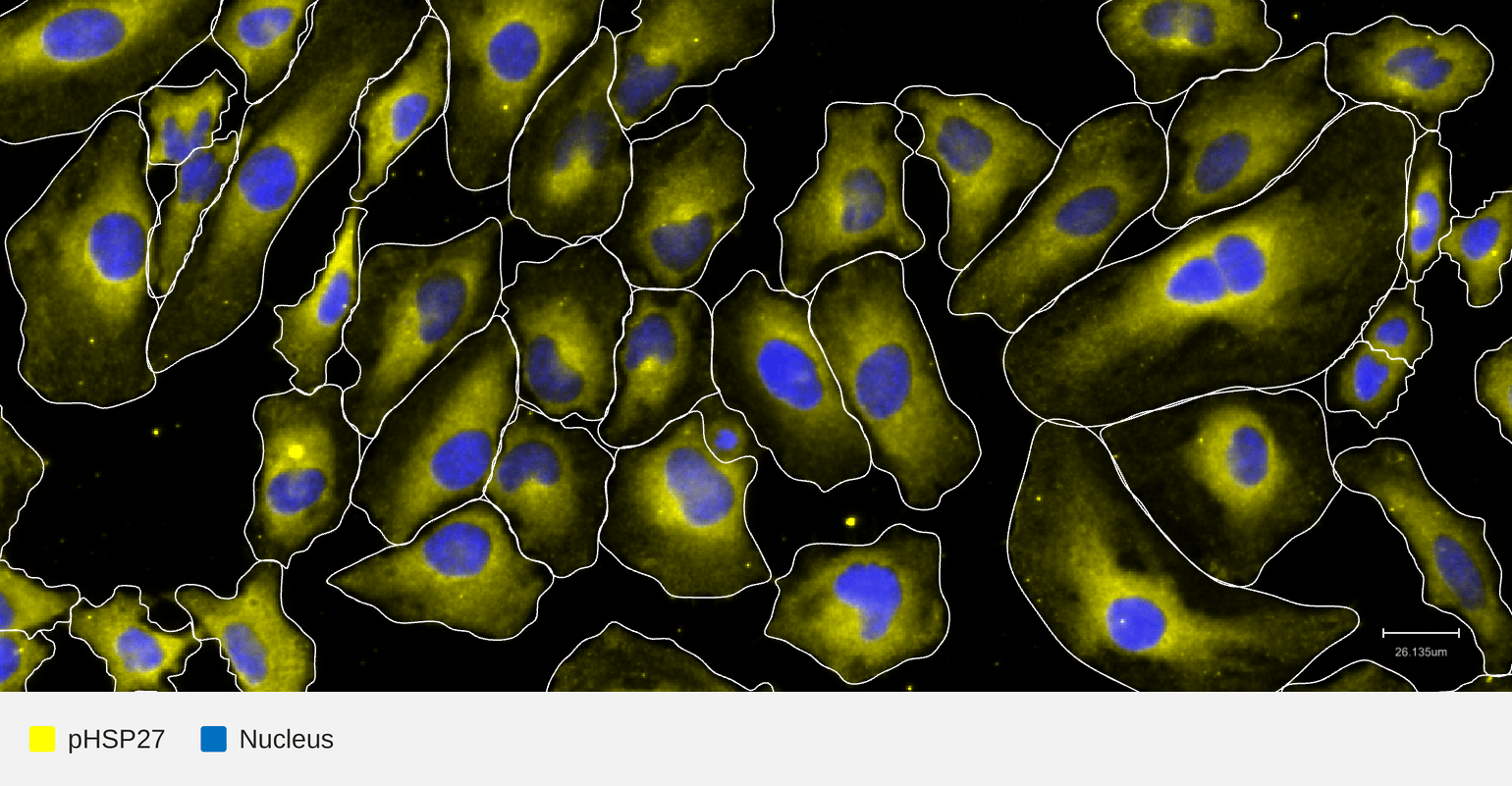 pHSP27-target-nucleus-hela-untreated (1)