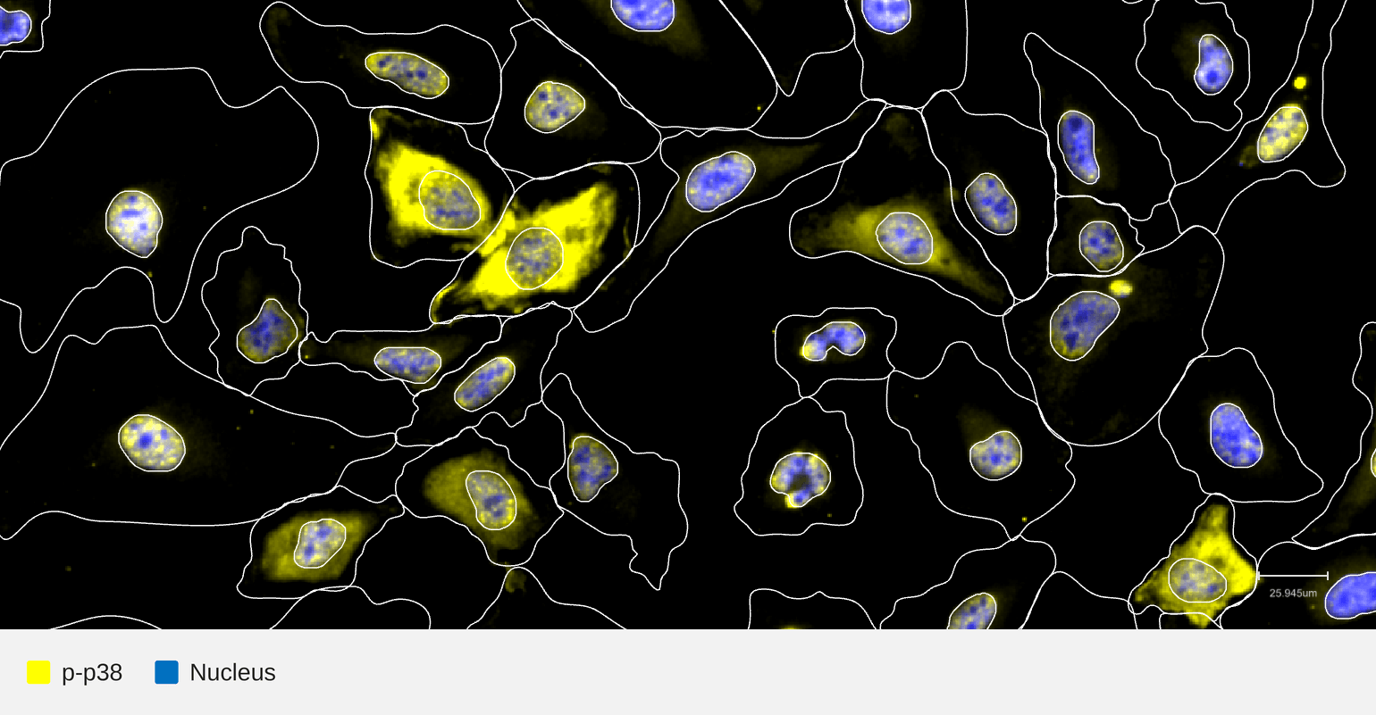 pp38-target-nucleus-hela-tnfa30min