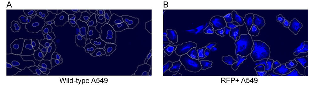 Fig1_SKBR-205_segmentation (1)