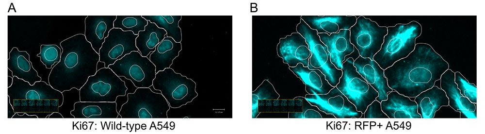 Fig2_SKBR-205_localization (1)