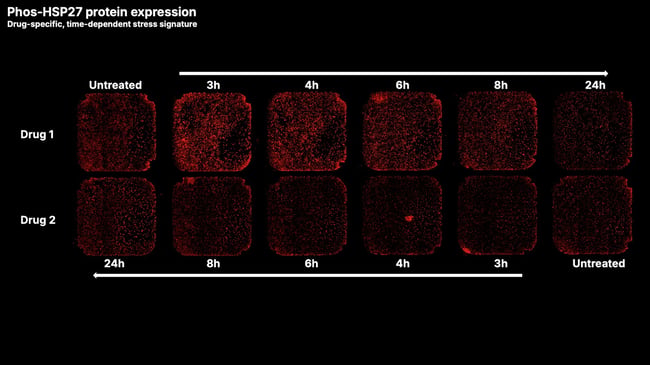 phos-hsp27