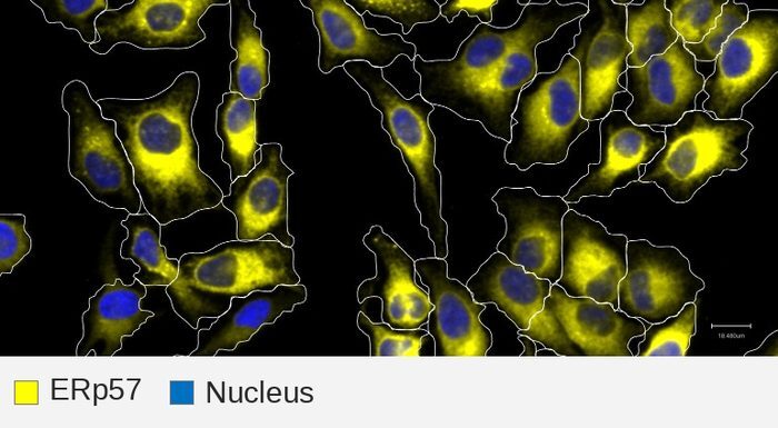 ERp57 target + nucleus, HeLa
