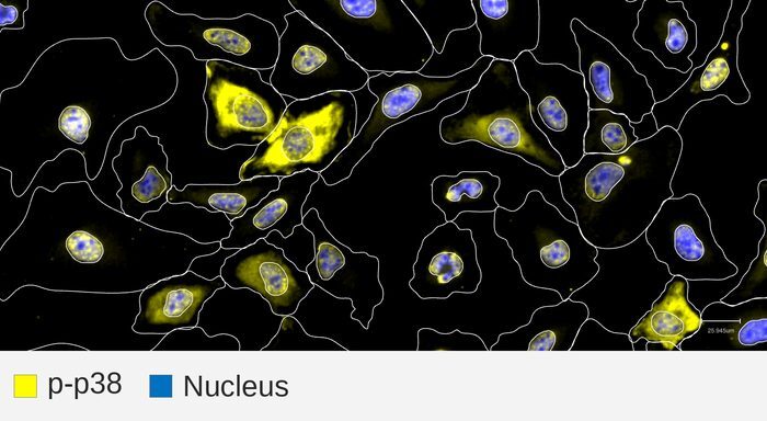 Phospho-p38 target + nucleus, HeLa, TNFa 30 min