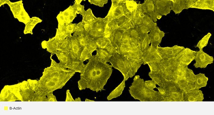 Beta-Actin target channel