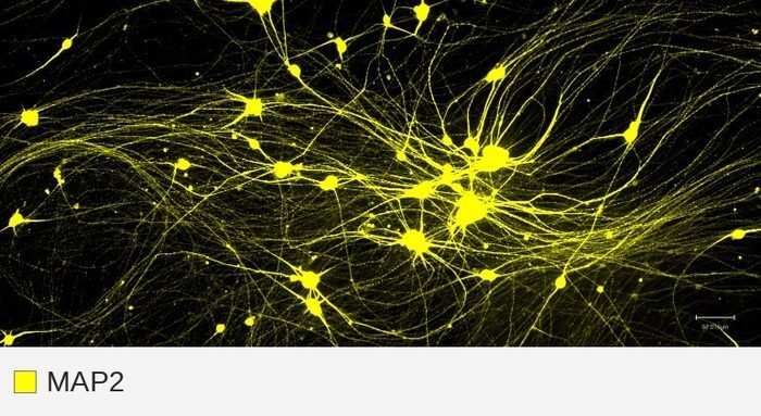 MAP2 target channel, iPSC-neurons