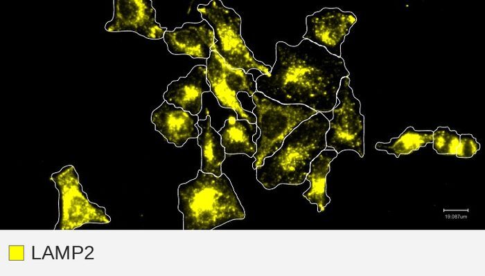 LAMP2 target channel, HeLa