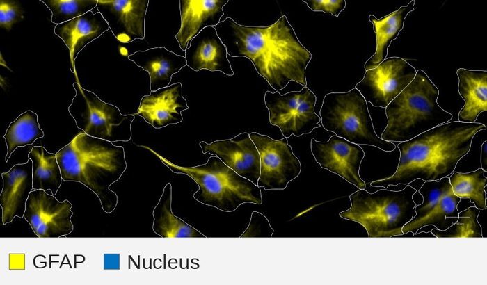 GFAP target + nucleus, U251