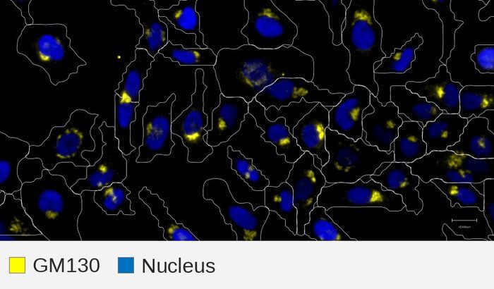 GM130 target + nucleus, HeLa